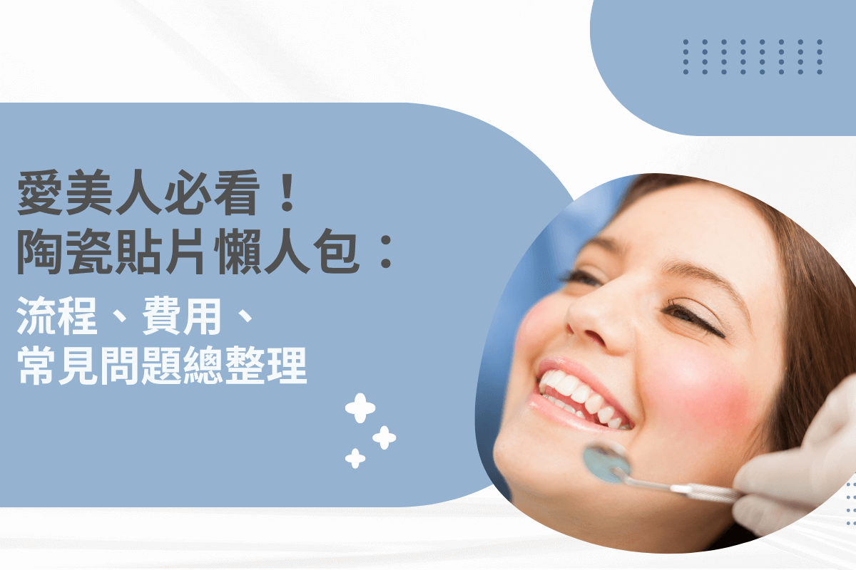 陶瓷貼片懶人包，牙齒美容流程與費用懶人圖解