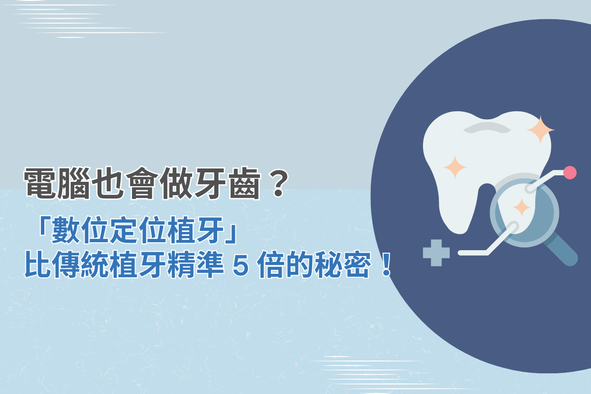 電腦導引數位植牙封面圖