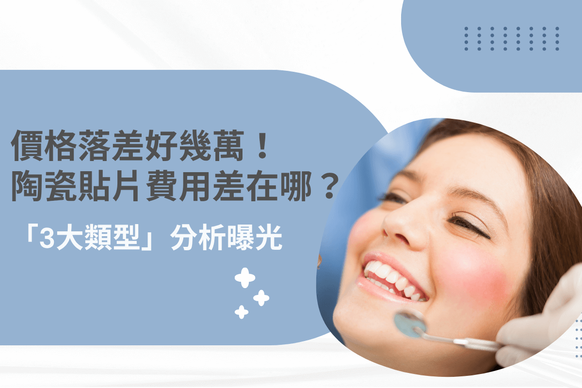 陶瓷貼片費用差異與三大類型分析圖