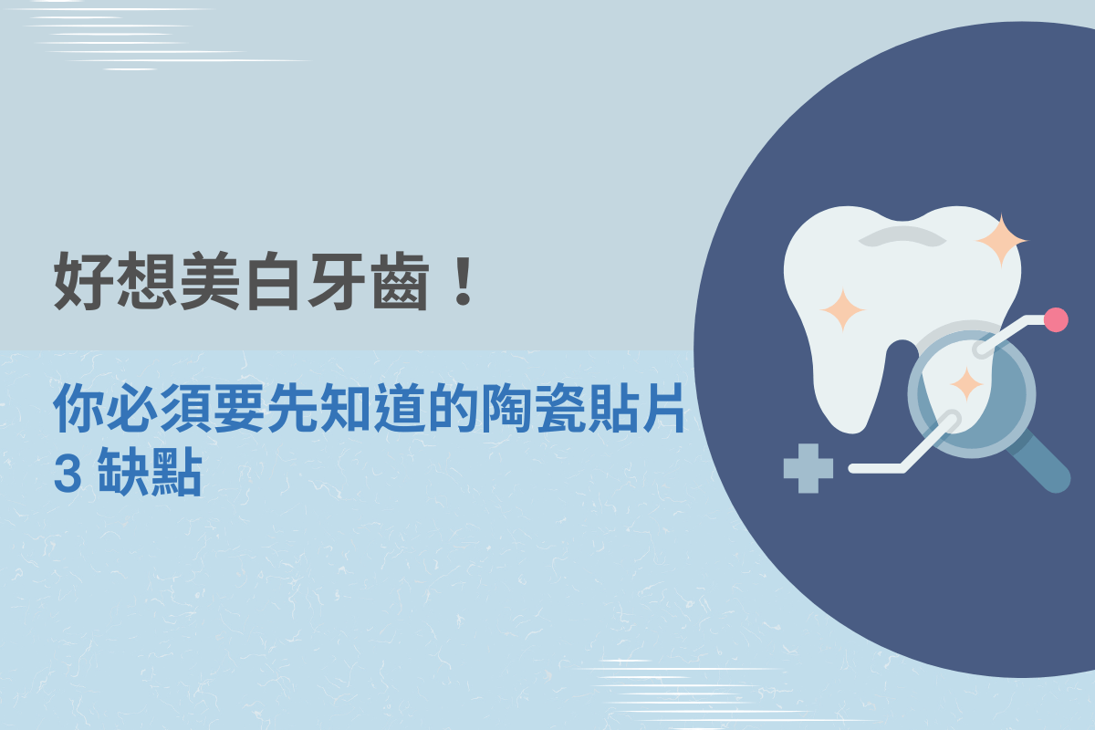美白牙齒與陶瓷貼片注意事項宣傳圖