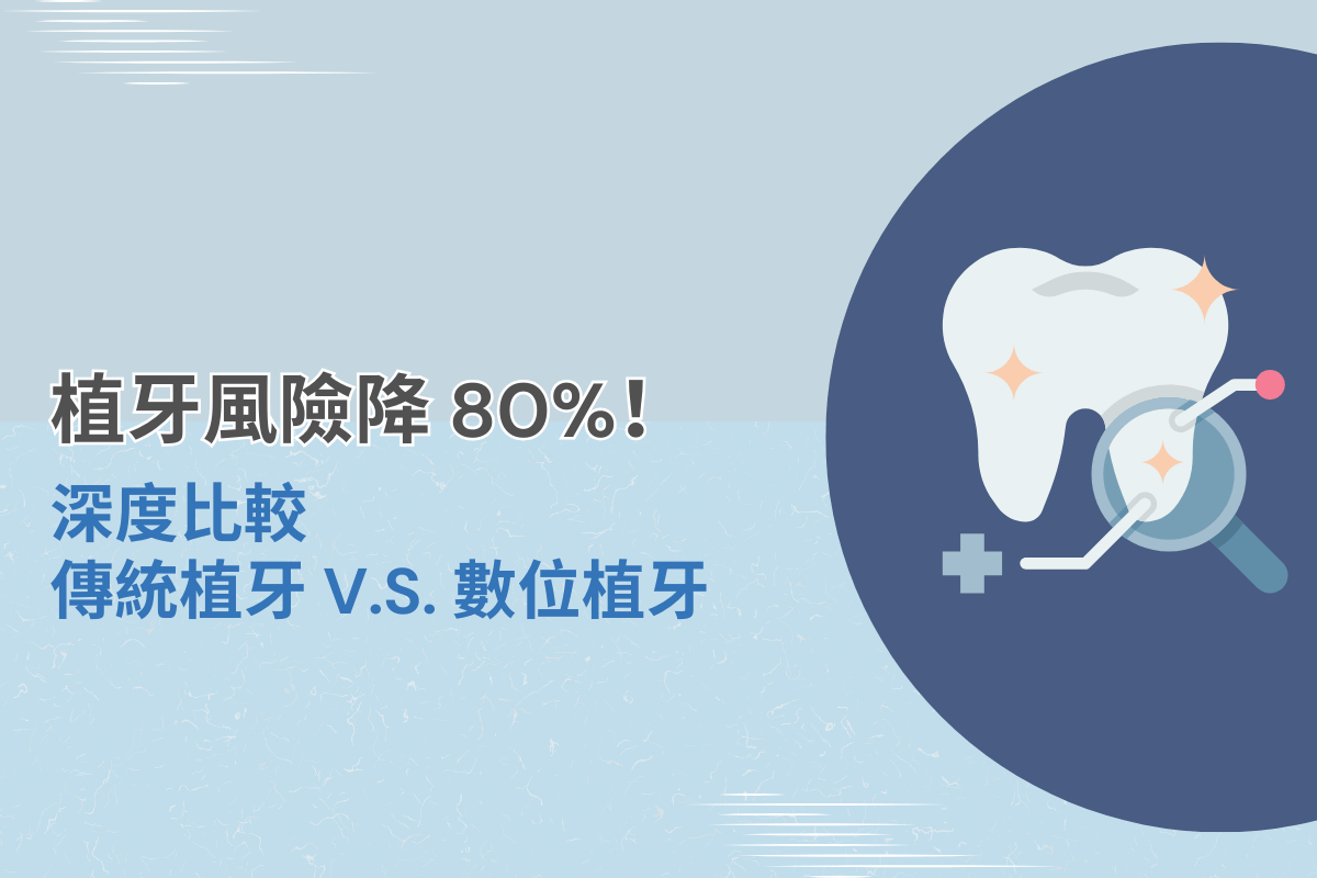 傳統植牙與數位植牙比較封面圖