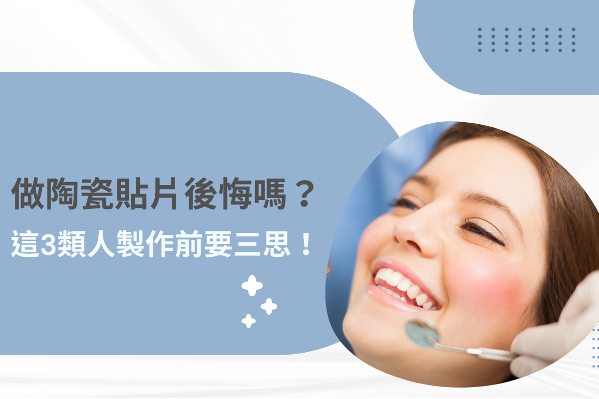 陶瓷貼片後悔案例封面圖