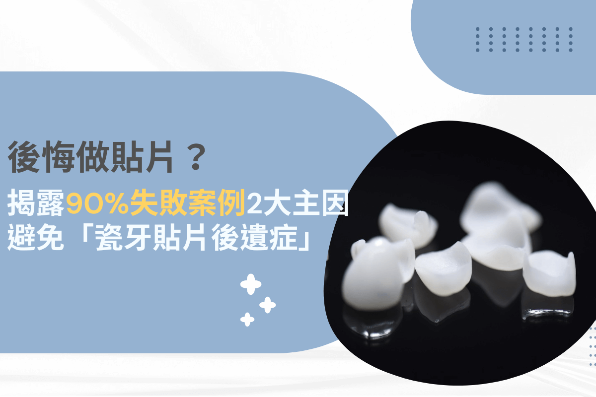 陶瓷貼片失敗案例與後遺症封面圖