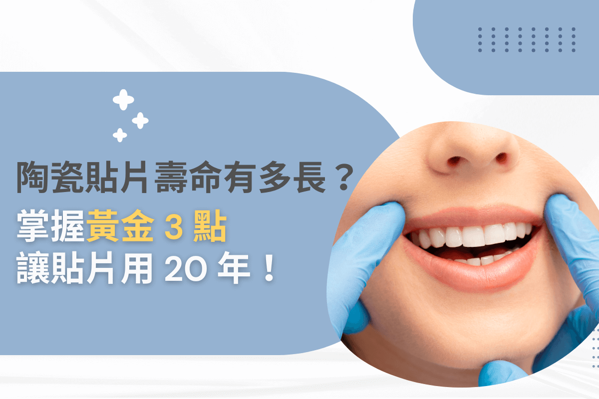 陶瓷貼片壽命有多長？掌握黃金3點讓貼片用20年