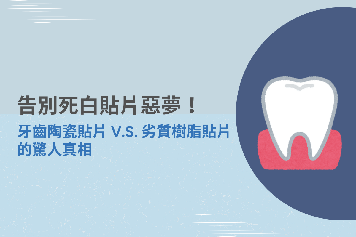 牙齒陶瓷貼片 VS 劣質樹脂貼片差異