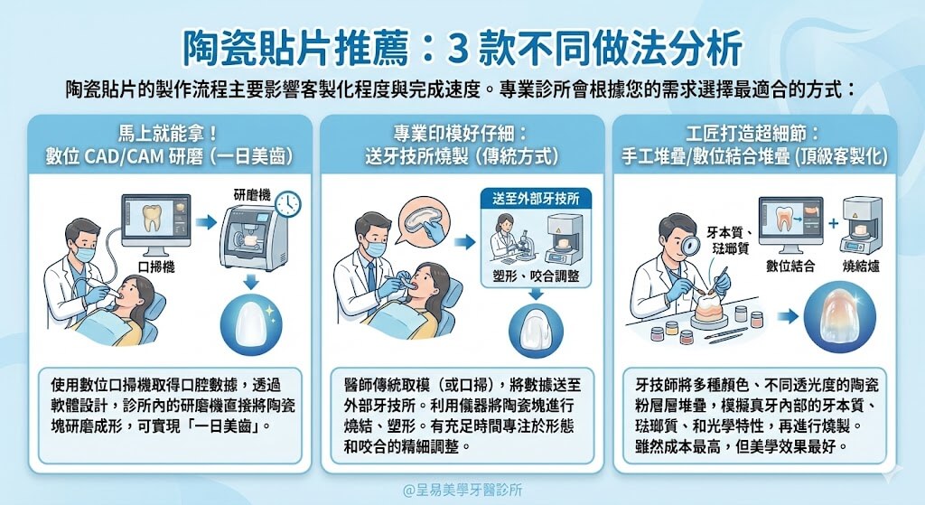 陶瓷貼片推薦：3 款不同做法分析