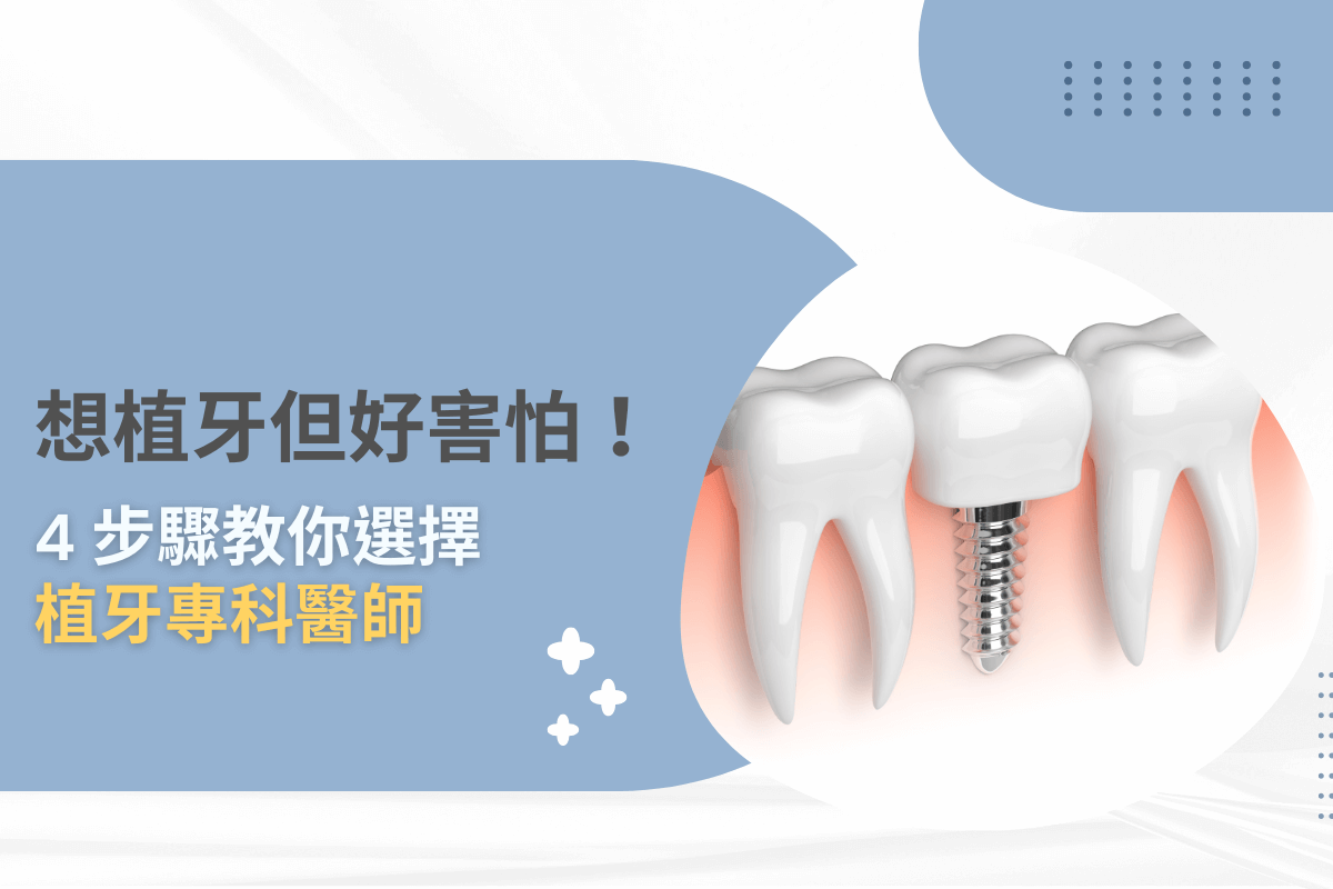 想植牙但好害怕！4步驟教你選擇植牙專科醫師