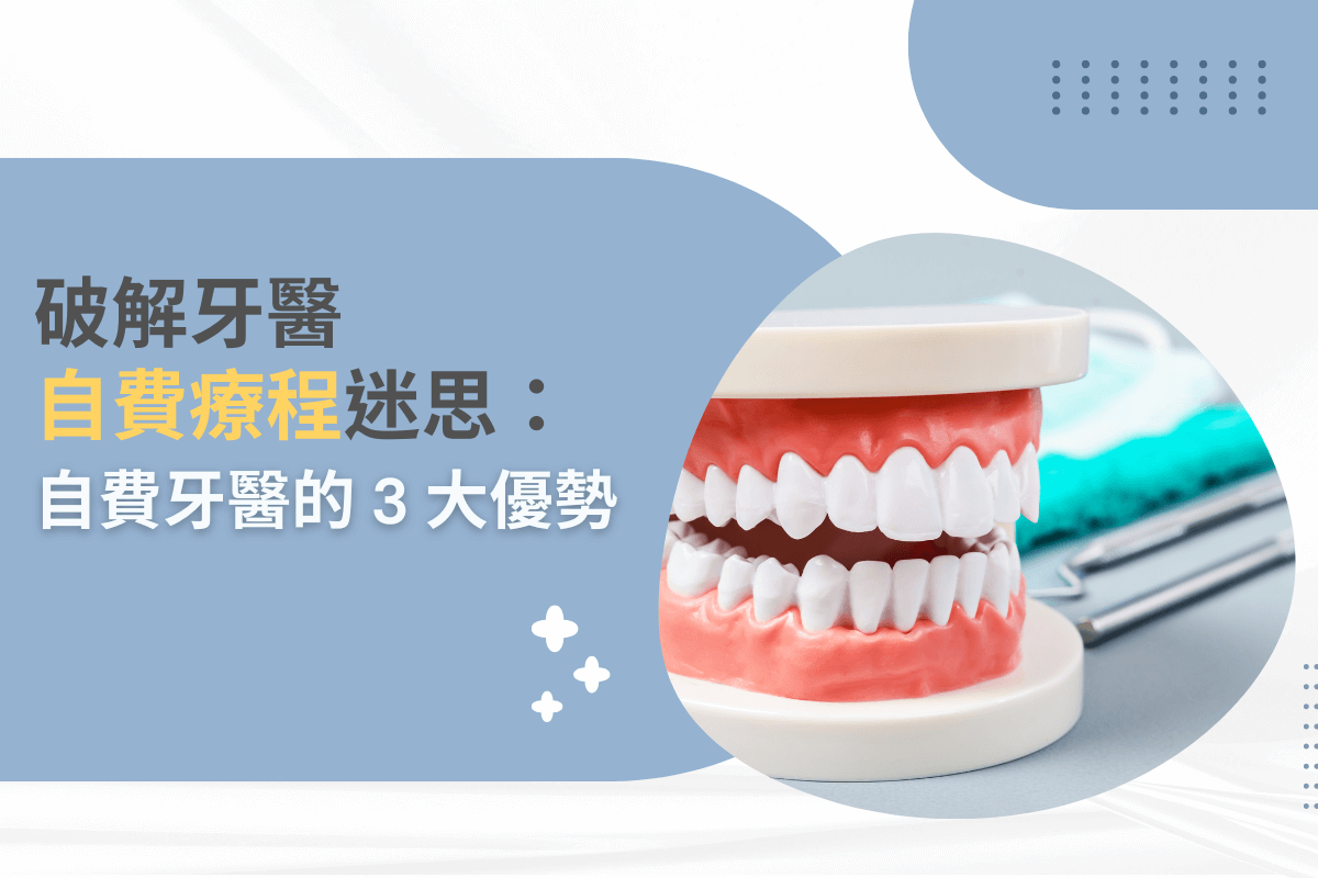 破解牙醫自費療程迷思：自費牙醫的 3 大優勢