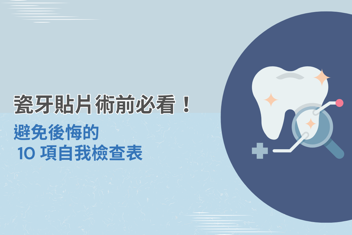 瓷牙貼片術前必看！避免後悔的 10 項自我檢查表