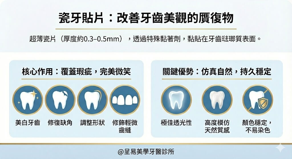瓷牙貼片：改善牙齒美觀的贋復物