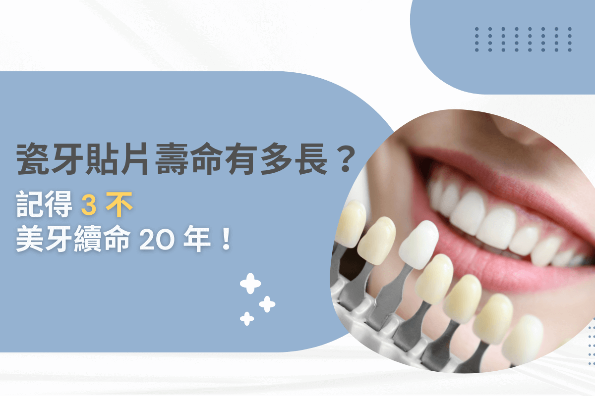 瓷牙貼片壽命有多長？記得 3 不，美牙續命 20 年！