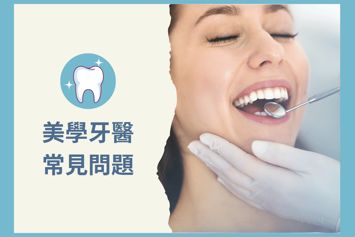 美學牙醫常見問題：一次解答您對美白與矯正的疑問