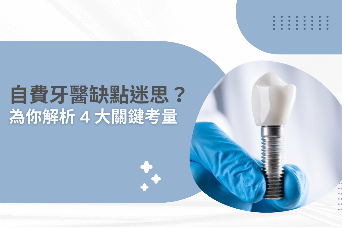 自費牙醫缺點迷思？為你解析4大關鍵考量