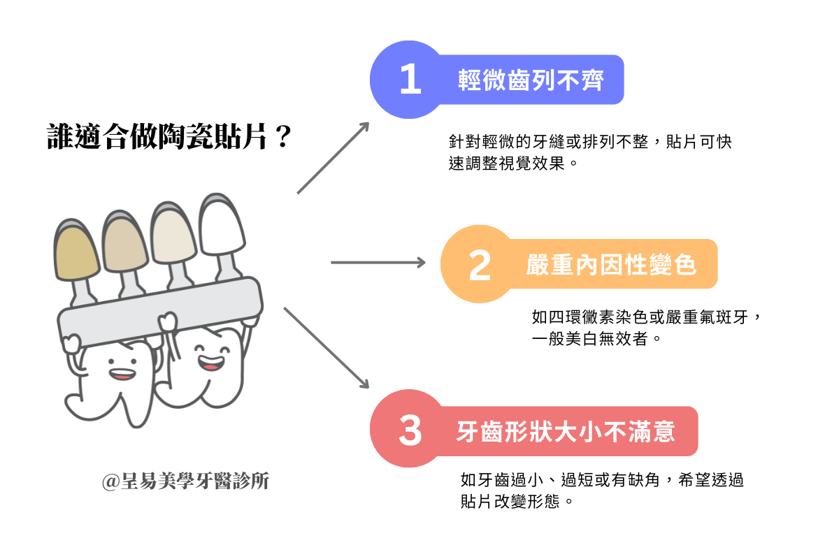 誰適合做陶瓷貼片？3 大常見適應症與族群