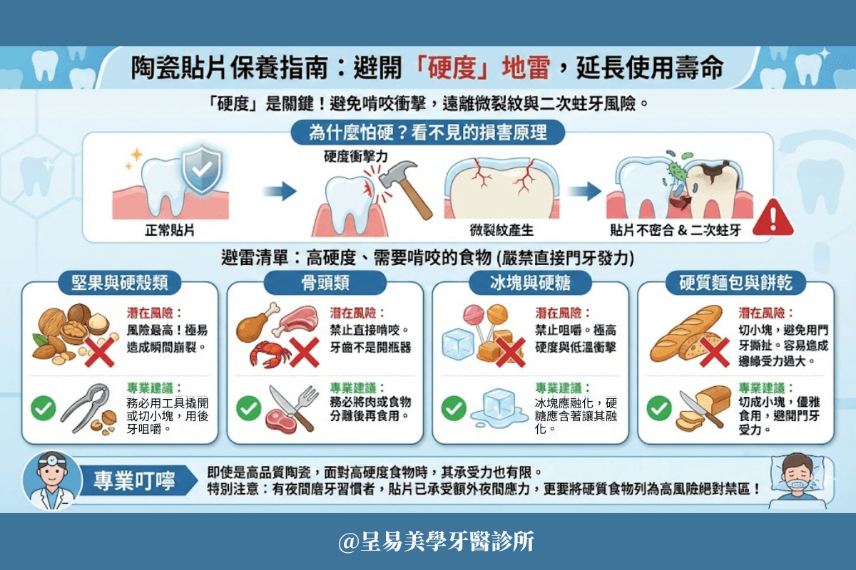 陶瓷貼片保養指南：避開「硬度」地雷，延長使用壽命