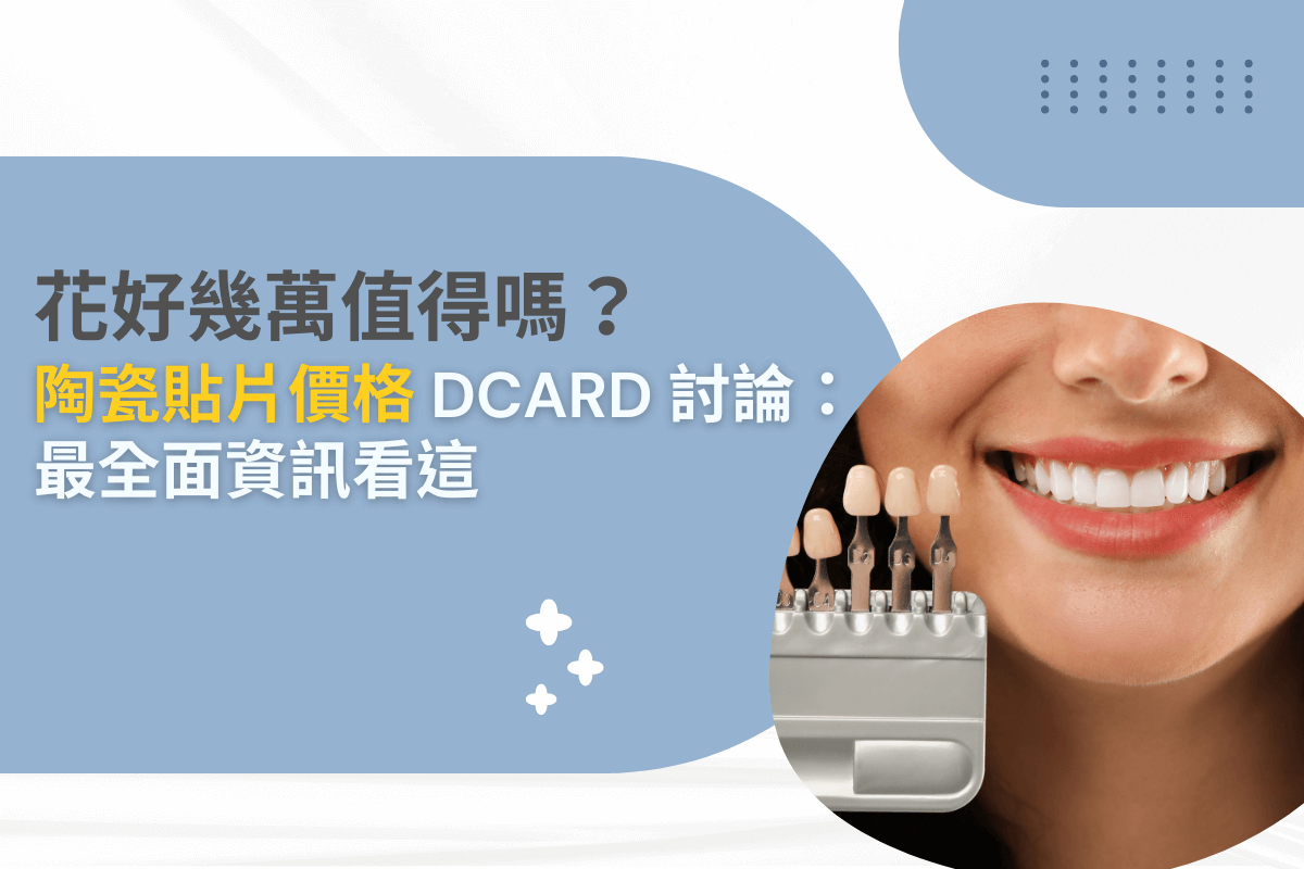 花好幾萬值得嗎？陶瓷貼片價格 DCARD 討論：最全面資訊看這