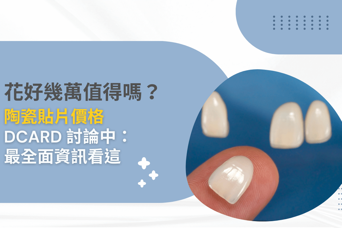 花好幾萬值得嗎？陶瓷貼片價格 Dcard 討論中：最全面資訊看這