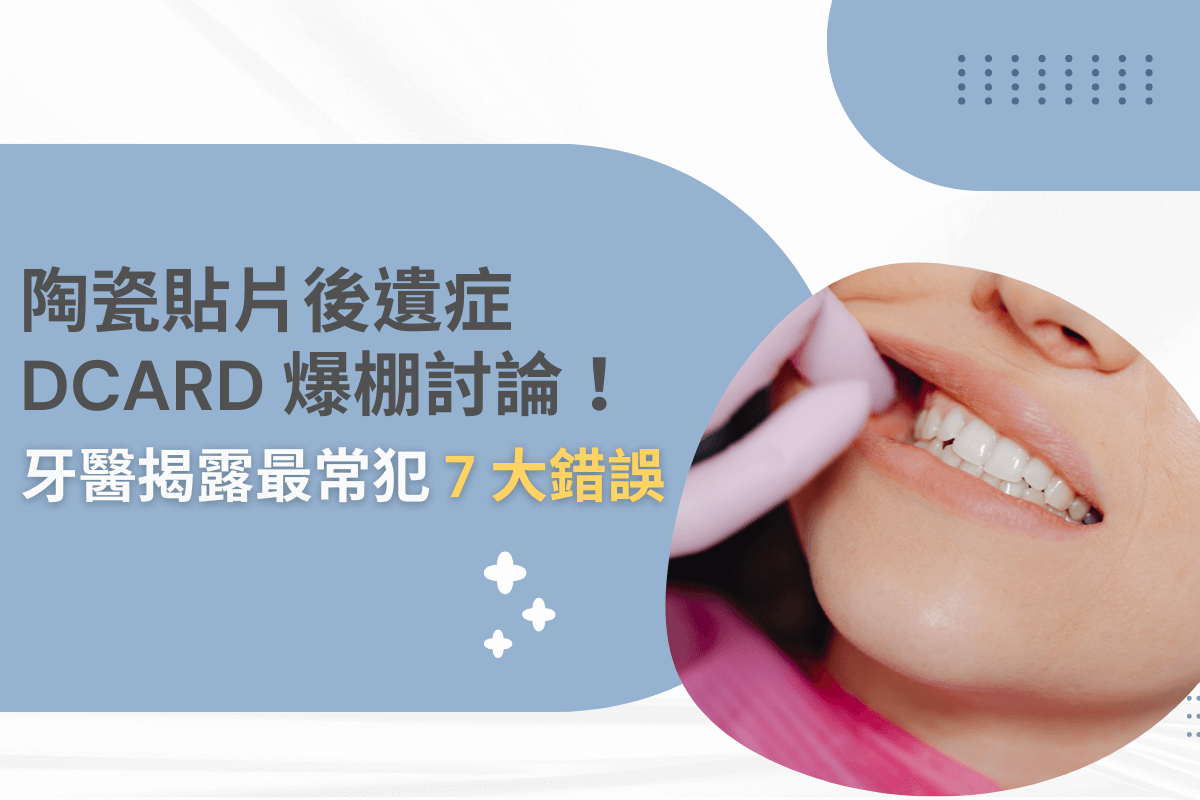 陶瓷貼片後遺症 Dcard 爆棚討論！牙醫揭露最常犯 7 大錯誤