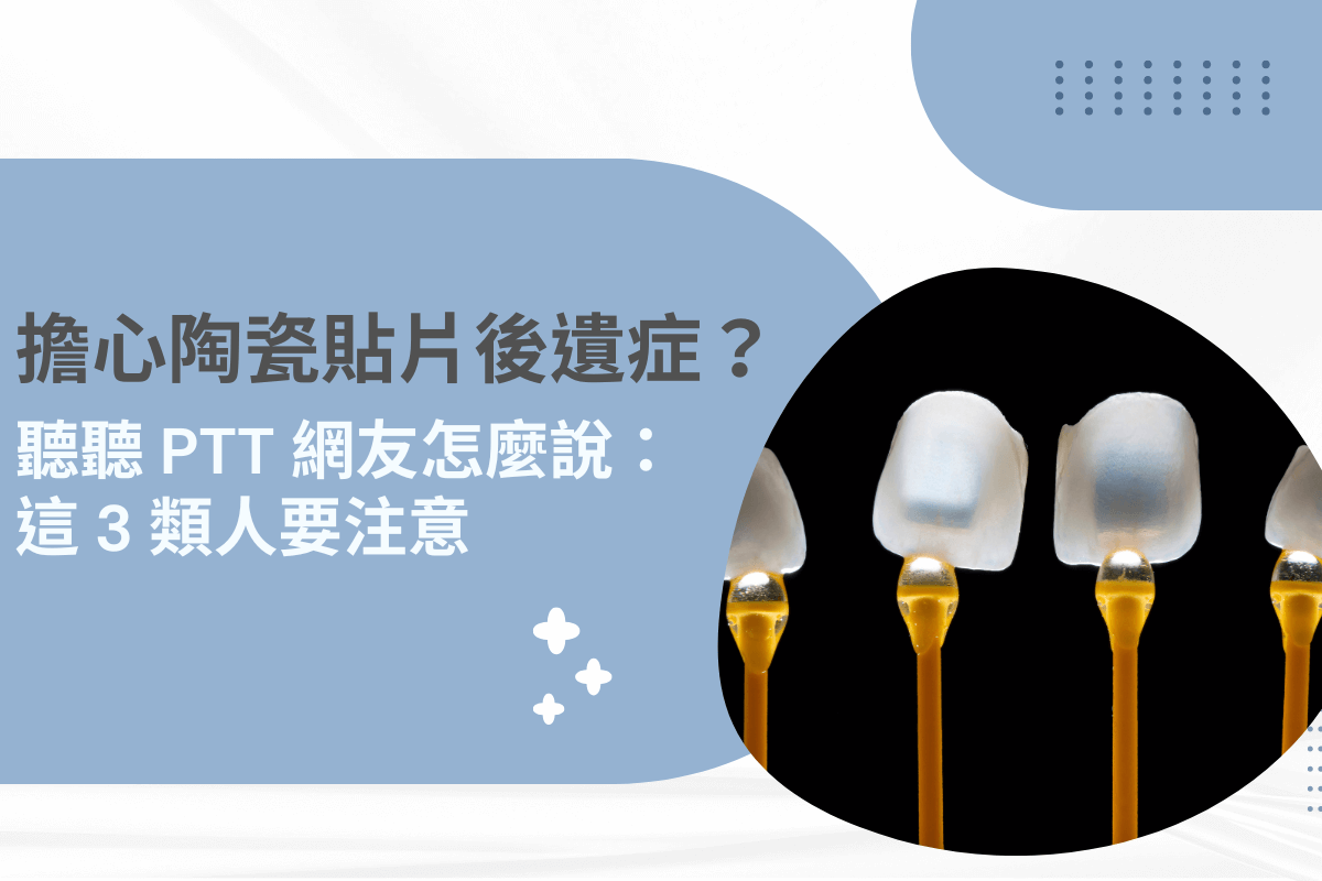 擔心陶瓷貼片後遺症？聽聽 PTT 網民怎麼說：這 3 類人要注意