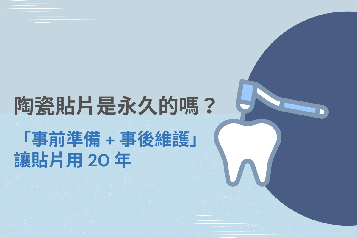 陶瓷貼片是永久的嗎？「事前準備＋事後維護」讓貼片用 20 年