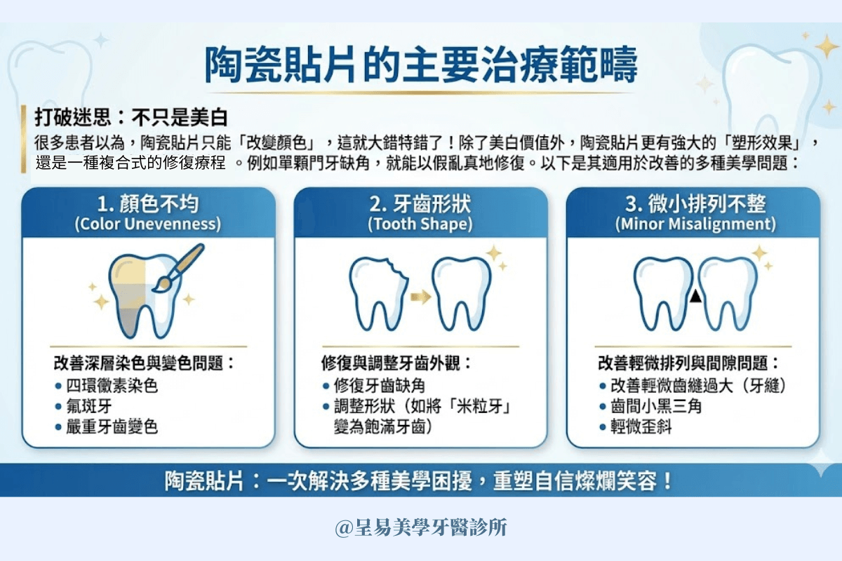 陶瓷貼片的主要治療範疇