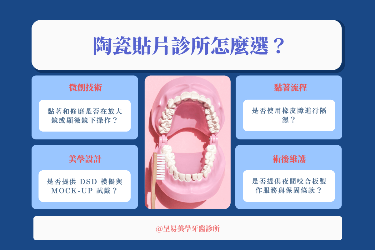 陶瓷貼片診所怎麼選？掌握微創技術、DSD 設計、橡皮障隔離與術後保固 4 大關鍵