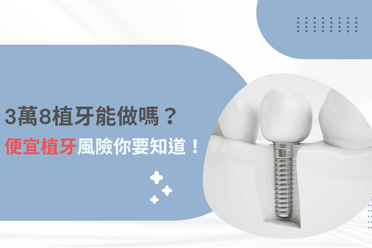 3萬8植牙能做嗎？便宜植牙隱藏風險大公開