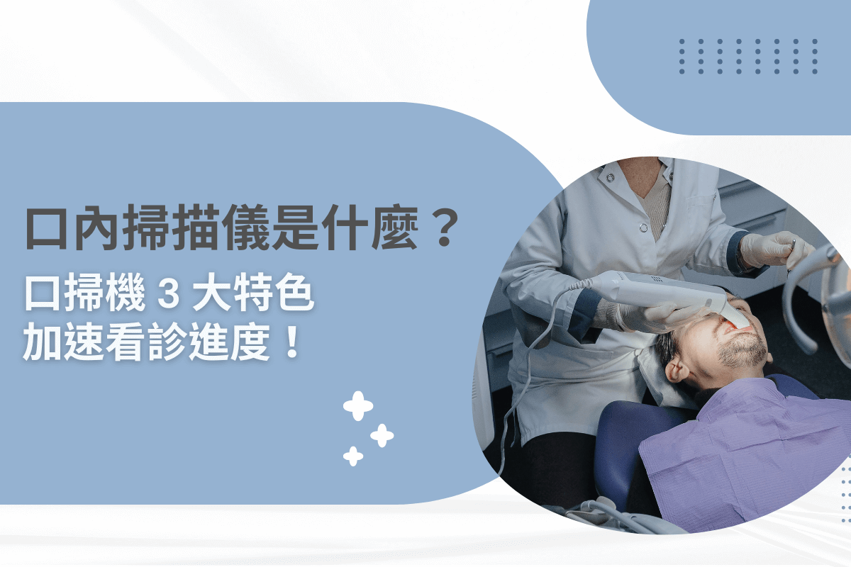 口內掃描儀是什麼？口掃機 3 大特色加速看診進度！
