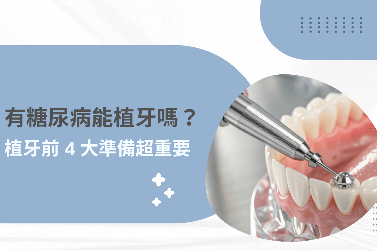 有糖尿病能植牙嗎？解析植牙前必做的 4 大準備