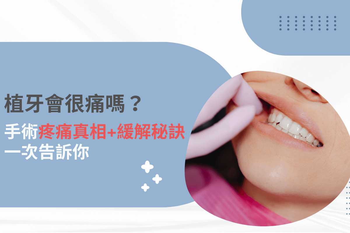 植牙會很痛嗎？手術疼痛真相與緩解秘訣一次告訴你