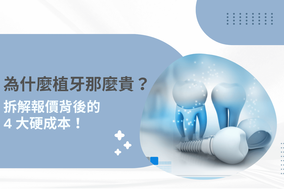 為什麼植牙那麼貴？拆解報價背後的 4 大硬成本！