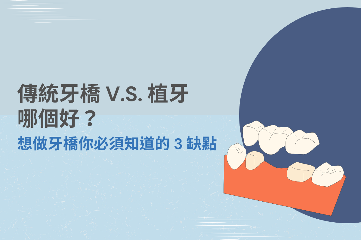 傳統牙橋 V.S. 植牙哪個好？想做牙橋你必須知道的 3 缺點