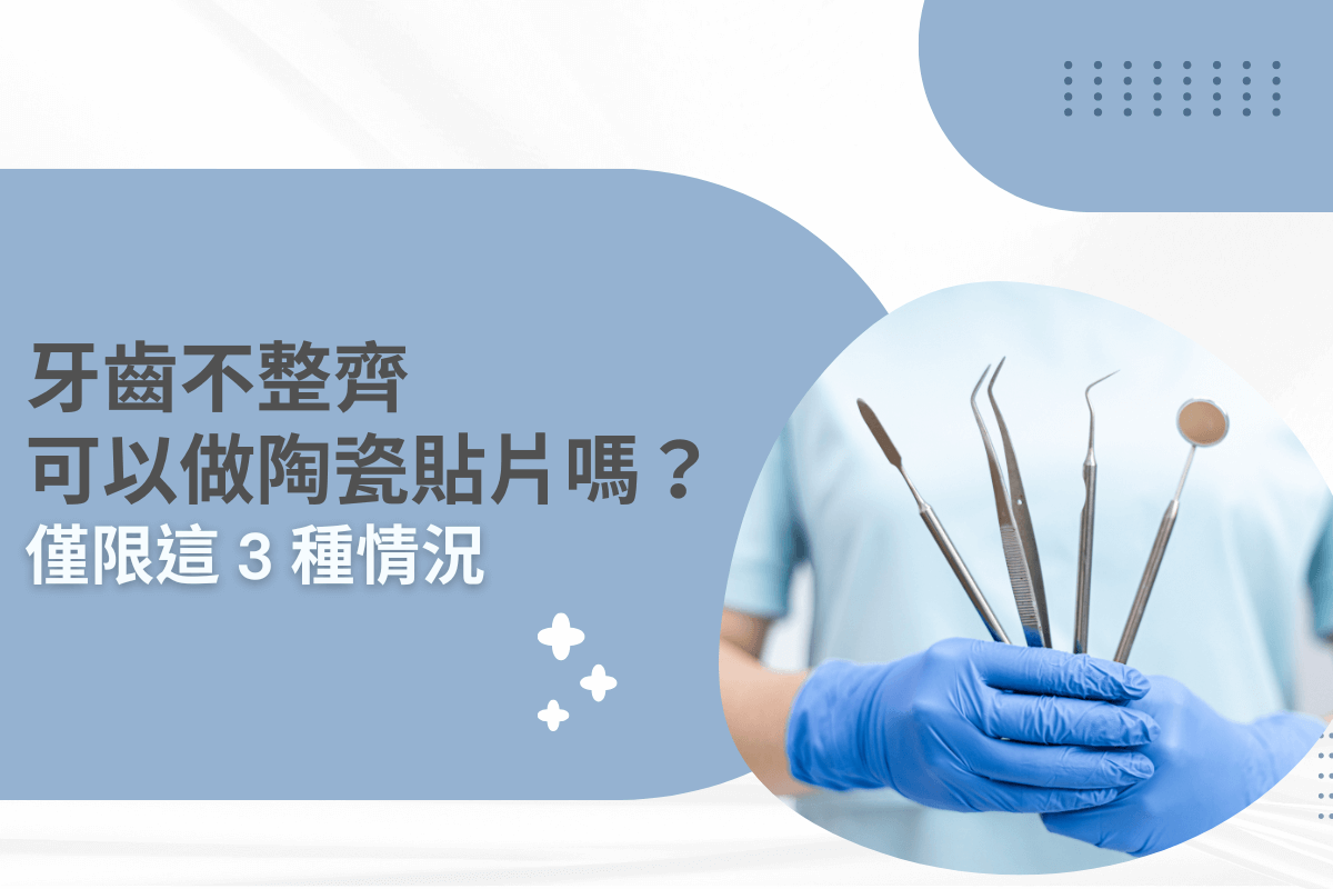 牙齒不整齊可以做陶瓷貼片嗎？僅限這 3 種情況