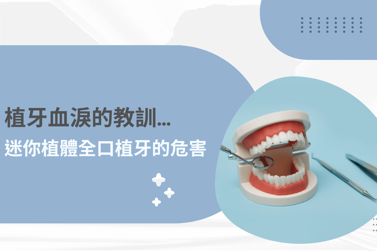 植牙血淚的教訓：揭開迷你植體全口植牙的潛在危害