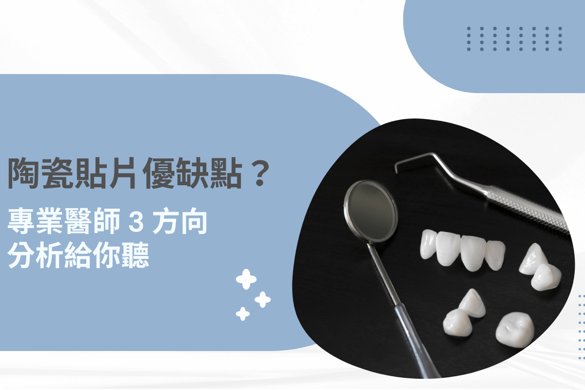 陶瓷貼片優缺點？專業醫師 3 方向分析給你聽