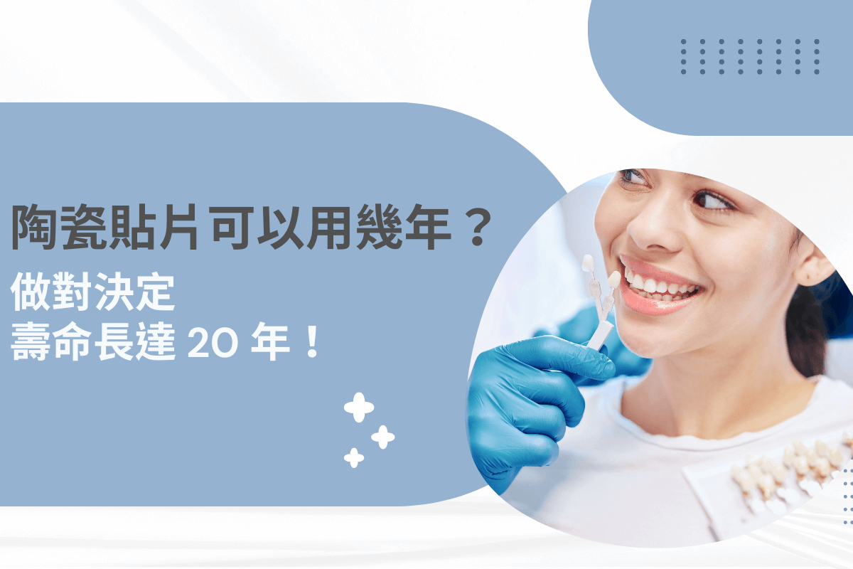 陶瓷貼片可以用幾年？做對決定壽命長達 20 年！