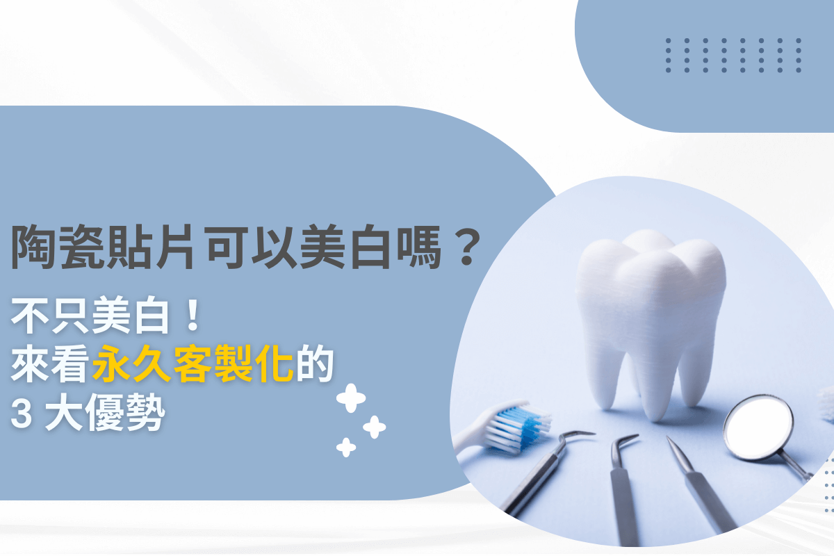 陶瓷貼片可以美白嗎？不只美白！來看永久客製化的3大優勢