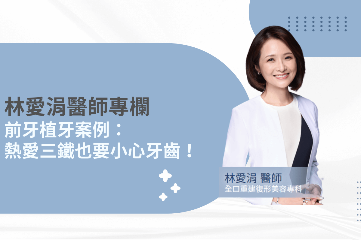 林愛涓醫師專欄：前牙植牙案例——熱愛三鐵也要小心牙齒！