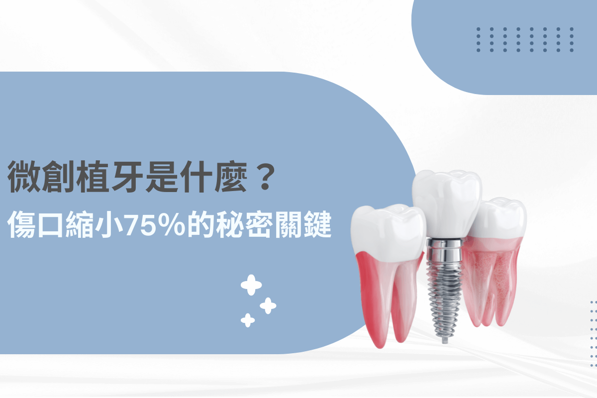 微創植牙是什麼？揭開傷口縮小 75% 的秘密關鍵