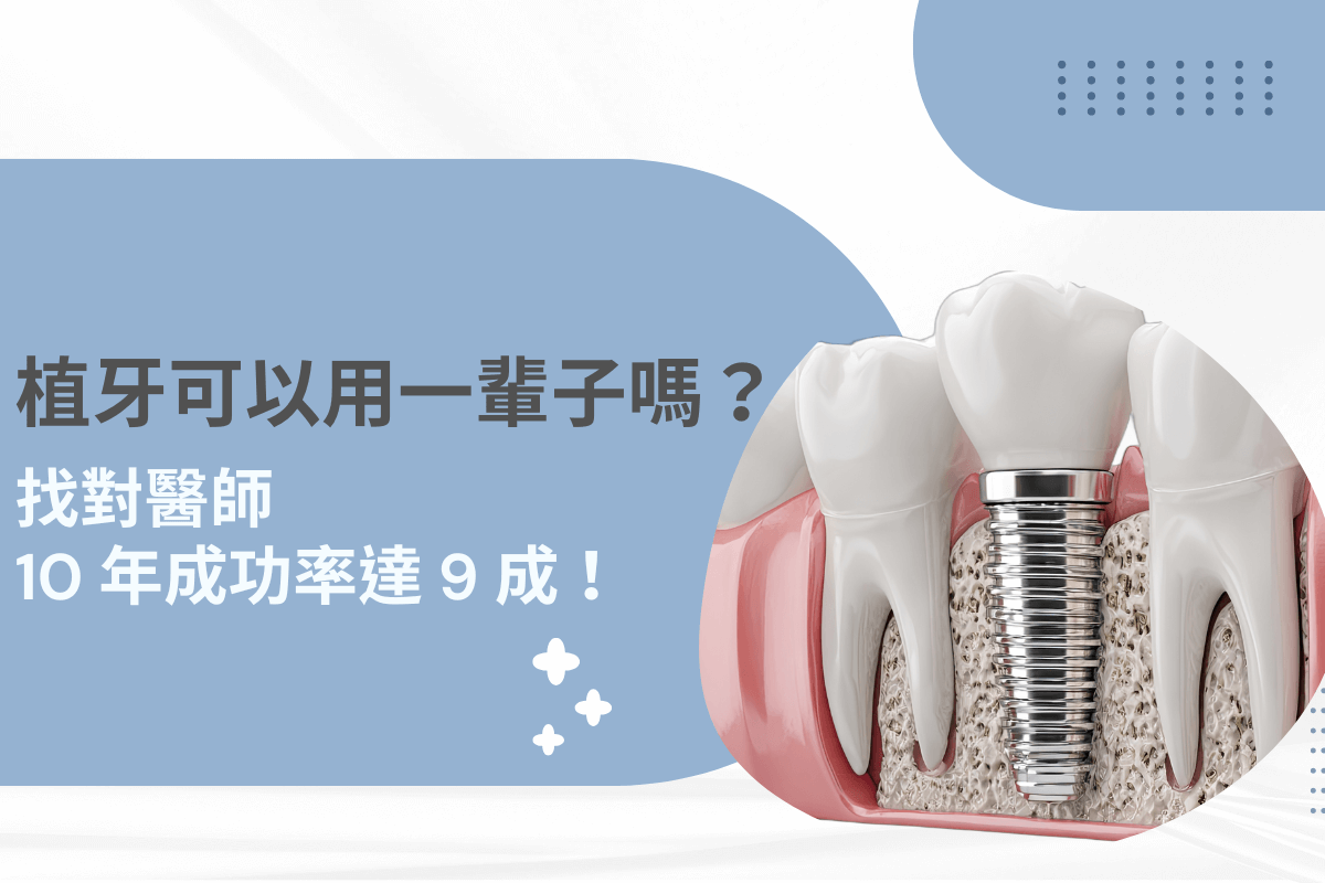 植牙可以用一輩子嗎？找對醫師是成功的關鍵