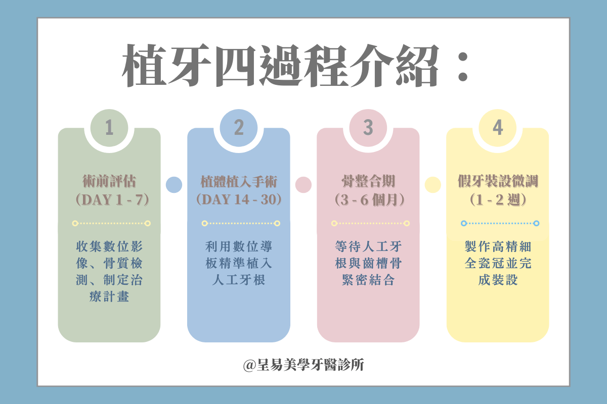 植牙四過程全解析：從評估到裝設的完整時程表