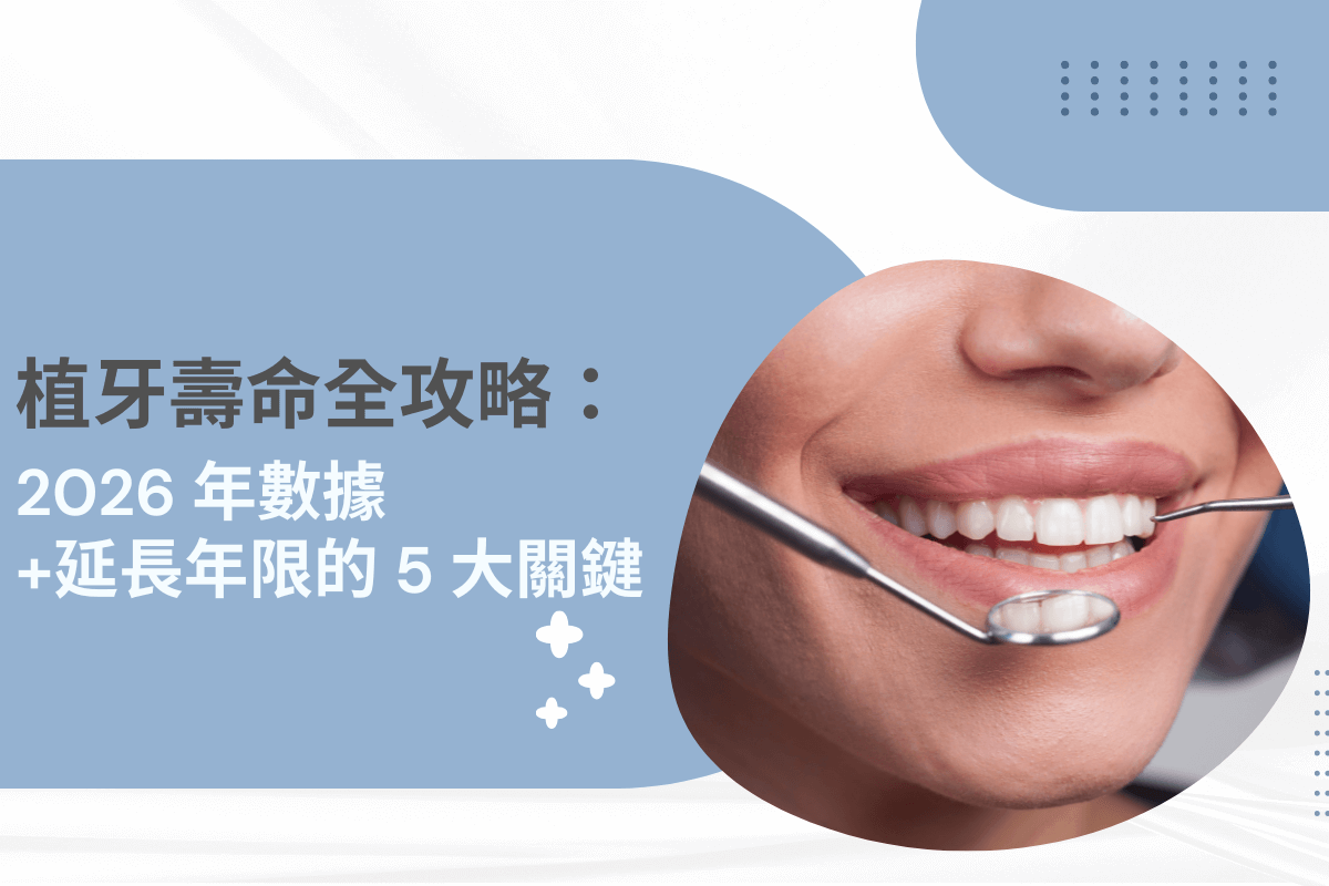 植牙壽命全攻略：2026 年數據與延長年限的 5 大關鍵