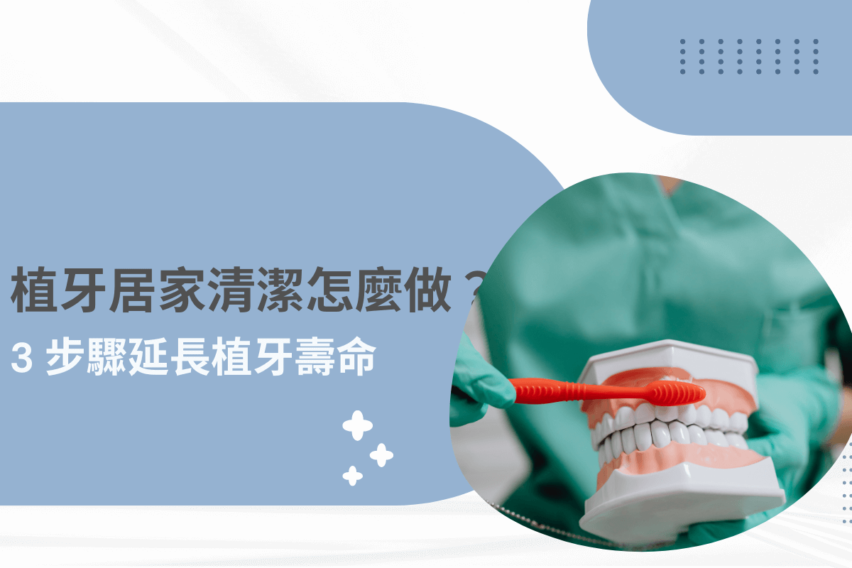植牙居家清潔怎麼做？3 步驟延長植牙壽命