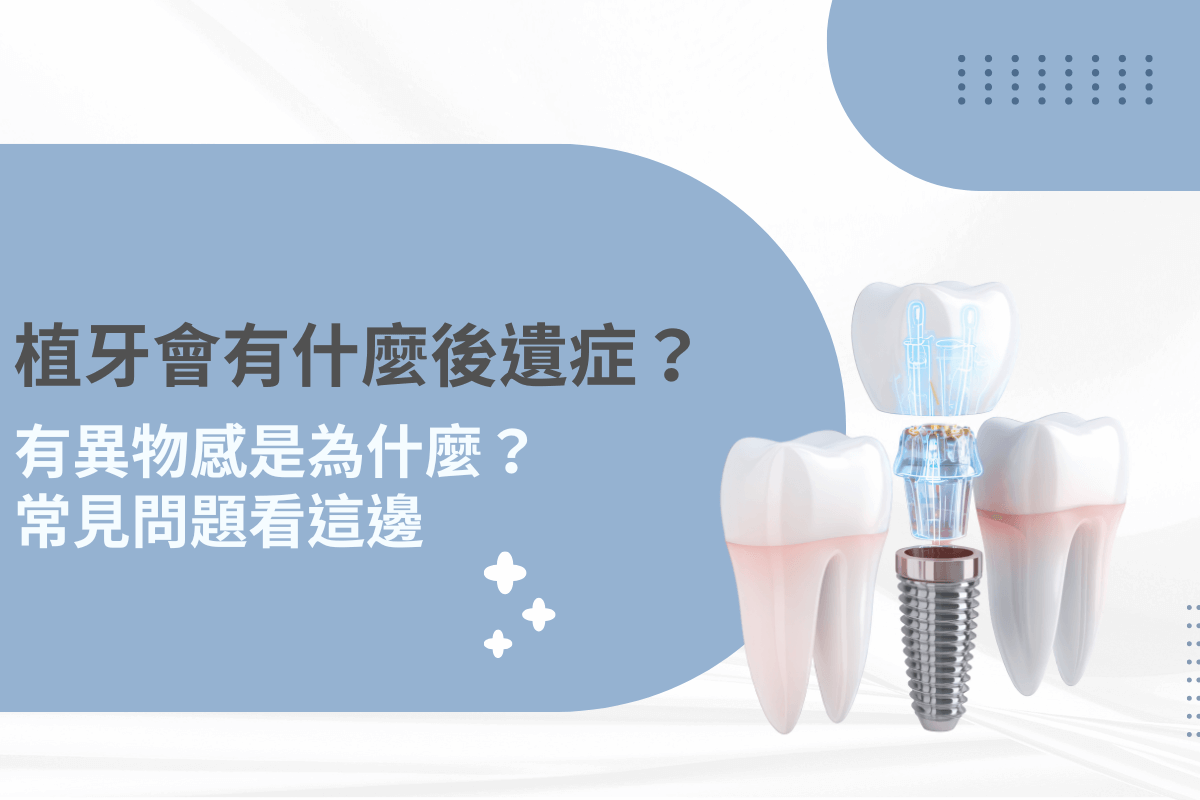 植牙會有什麼後遺症？專業解析異物感原因與常見問題