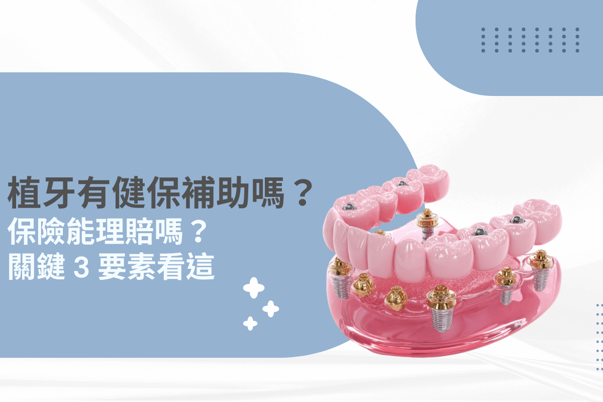 植牙有健保補助嗎？解析保險理賠與費用補助的 3 大關鍵