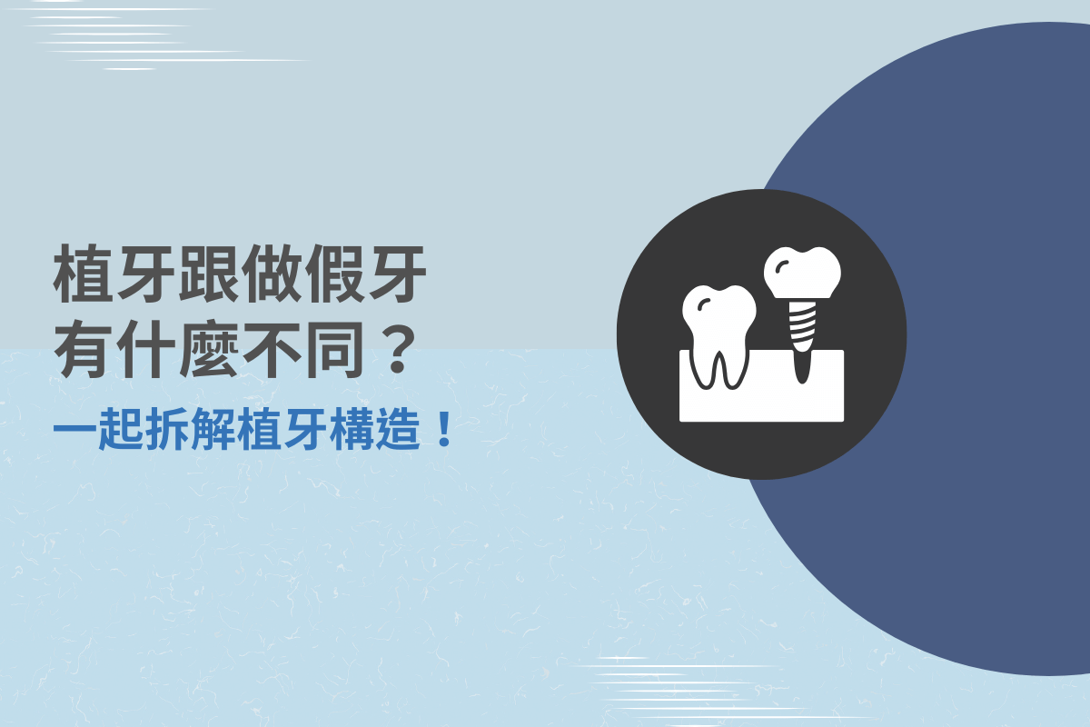 植牙跟做假牙有什麼不同？一起拆解植牙構造！