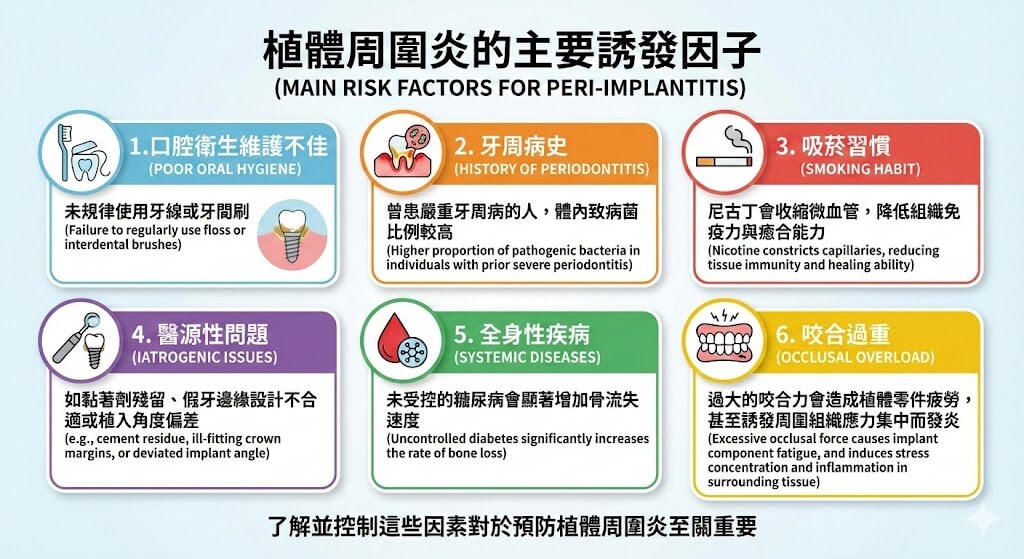 植體周圍炎的主要誘發因子:掌握 6 大關鍵預防植牙失敗