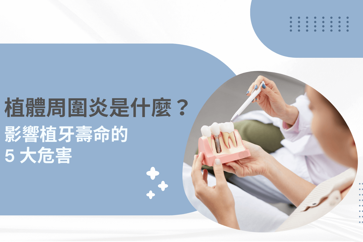 植體周圍炎是什麼？影響植牙壽命的 5 大危害