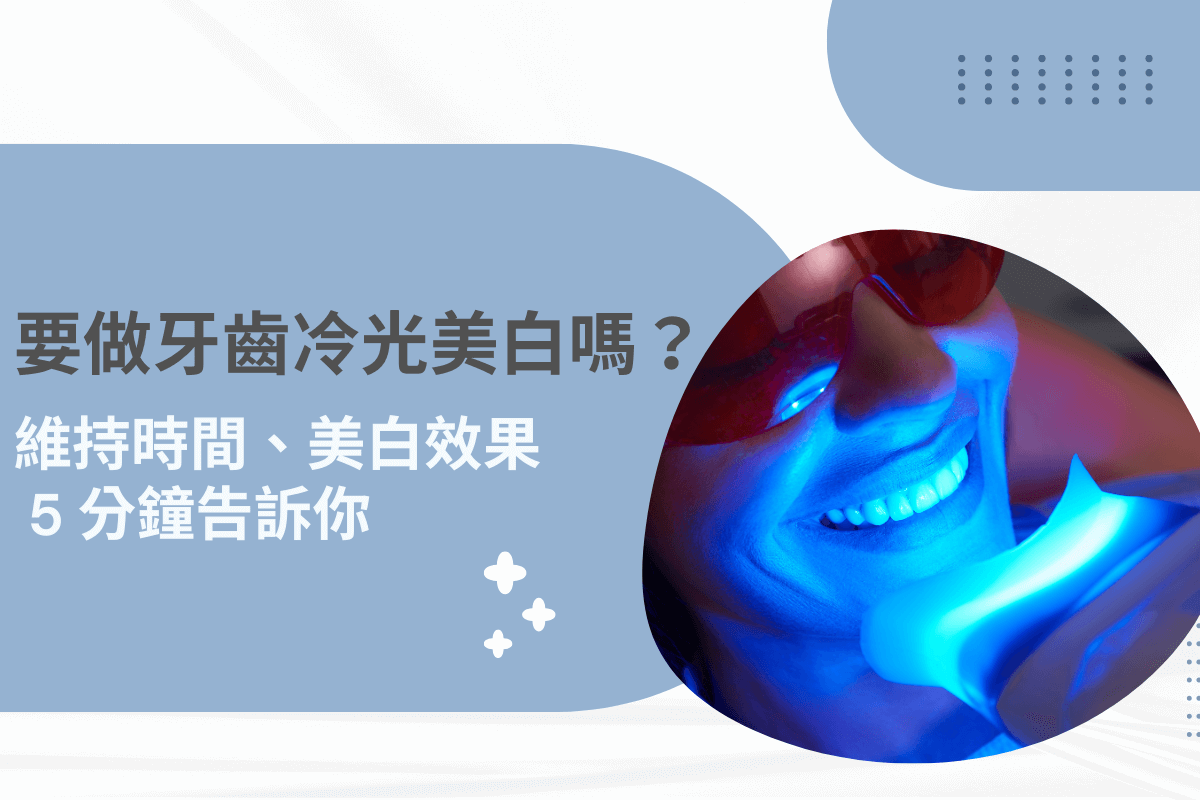 要做牙齒冷光美白嗎？維持時間、美白效果 5 分鐘告訴你