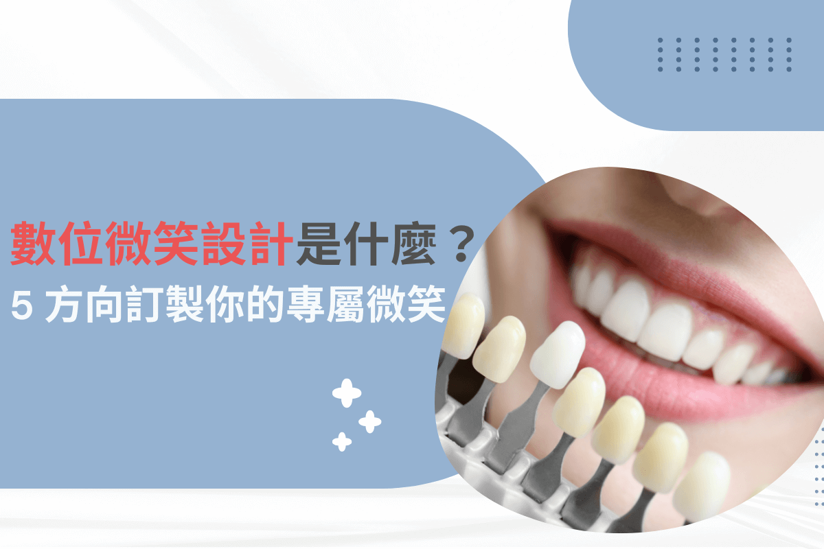 數位微笑設計是什麼？5 方向訂製你的專屬微笑